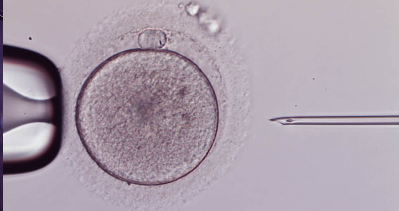 Intracytoplasmic Sperm Injection ICSI