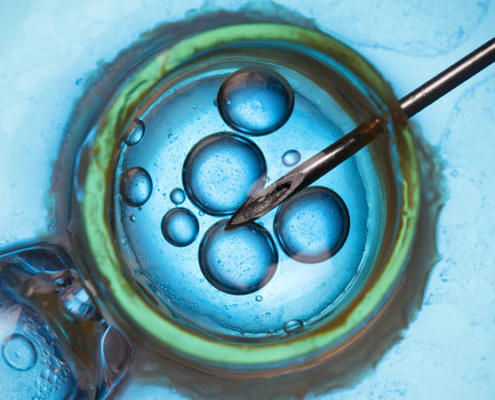 IVF and AI in the fertility lab