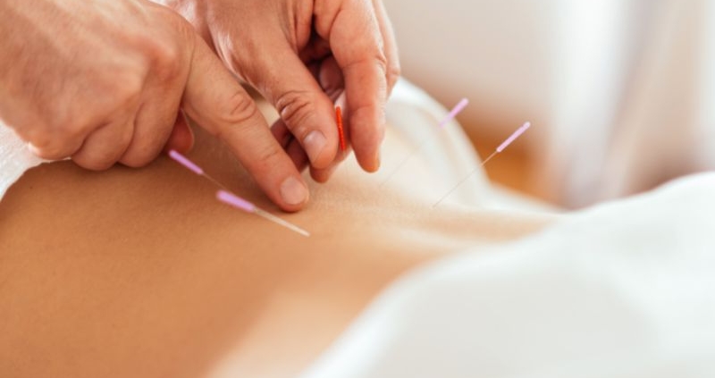 Fertility acupuncture explained