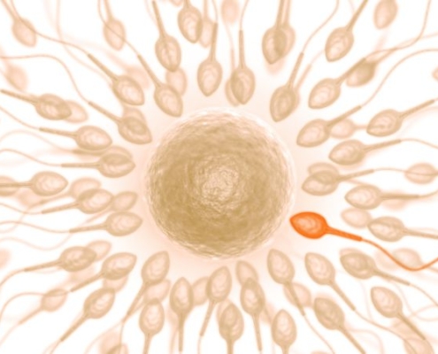 ICSI for male infertility